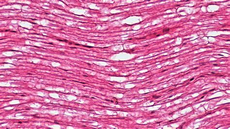 Mammalian Histology: Nervous Tissue – Berkshire Community College ...