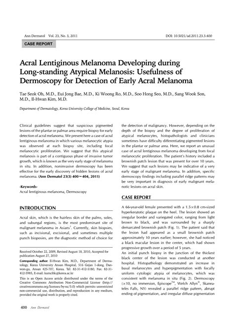 Acral Lentiginous Melanoma Developing During Long-Standing Atypical ...