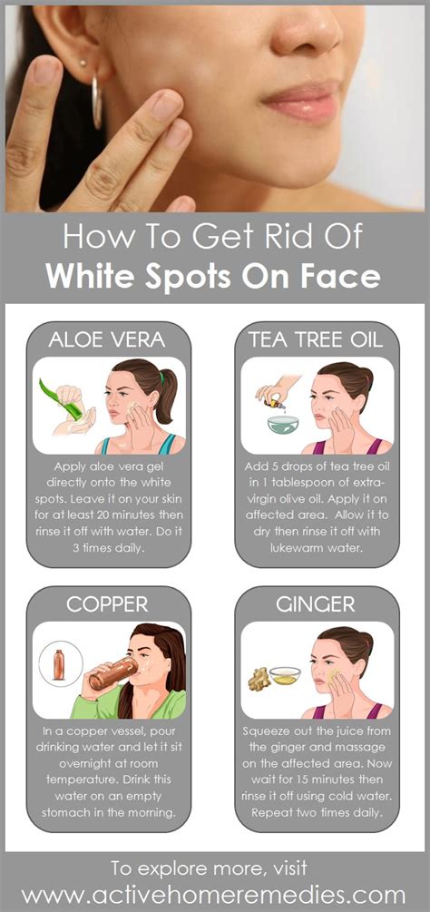 How to Get Rid of White Spots on Face | Active Home Remedies