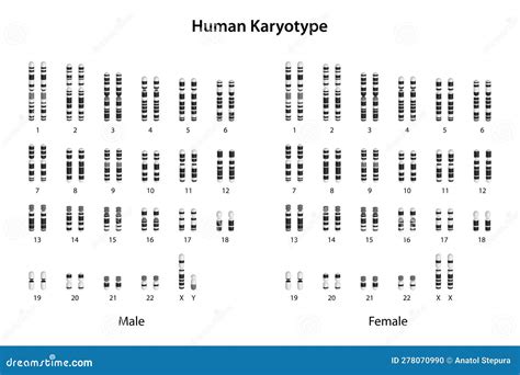 Human Karyotype (male and Female). Differential Staining. Stock Vector ...