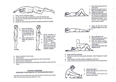 Scoliosis Exercises... Intended for brace wearers, but good for ...