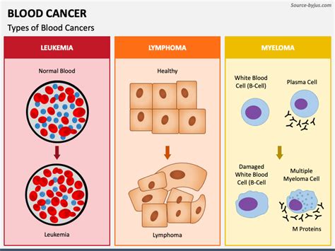 Blood Cancer PowerPoint and Google Slides Template - PPT Slides