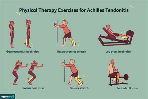 Achilles Tendonitis Exercises