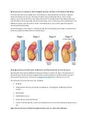 Kidney cancer treatment options