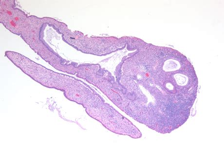 Endocervix Histology