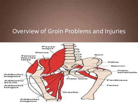 Groin Injuries And Problems