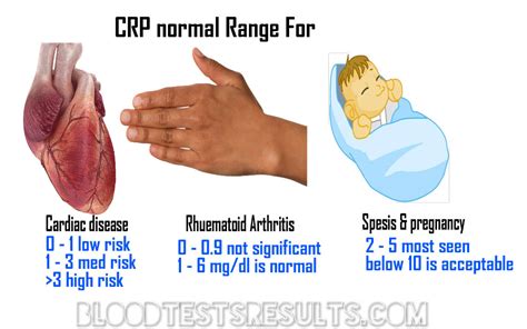 What is CRP Normal Range (rapid and Hs c-reactive protein normal range ...