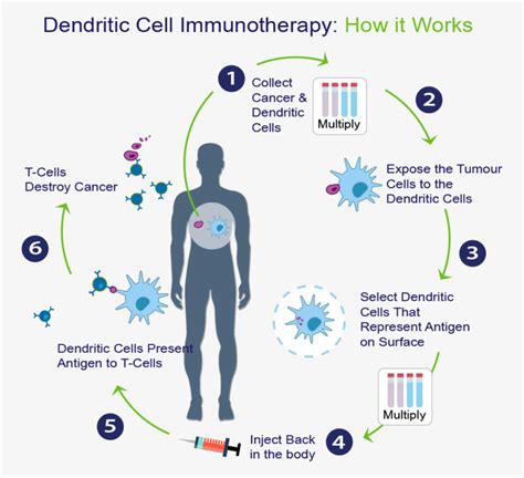 Stem Cell Treatment for Cancer in Mexico | Dendritic Cells Immunotherapy