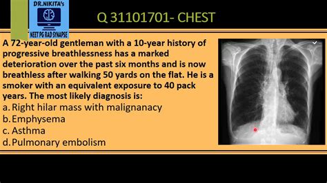 Chest X Ray Interpretation Copd Emphysema Youtube Images