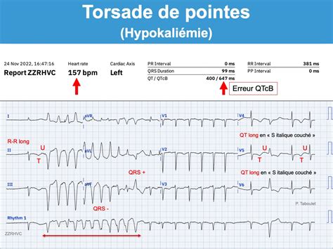 Tamirci türbin merchandiser torsades de pointes Kök gerçekleştirmek Heykel