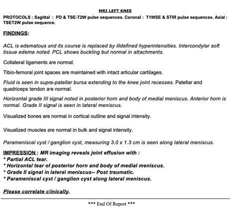 Knee MRI Cost, Purpose, Procedure, Risks & Results [2025]