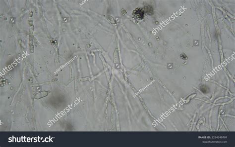 Fungal Hyphae Under Microscope Stock Photo 2234349797 | Shutterstock