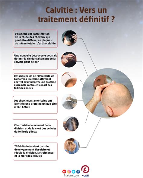 INFOGRAPHIE - Vers un traitement définitif de la calvitie?