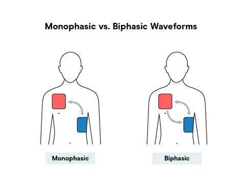 Monophasic vs. Biphasic Shocks - What's the Difference