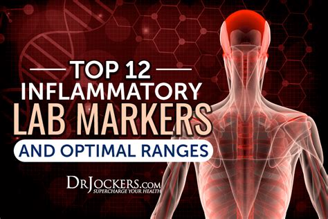 Top 12 Inflammatory Lab Markers and Optimal Ranges | Systemic ...