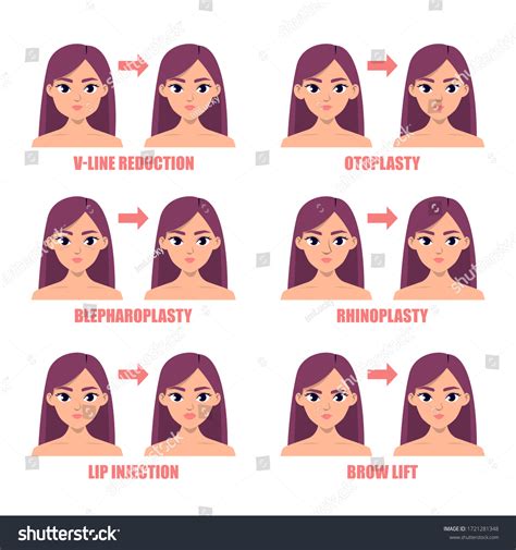 Types Plastic Surgery On Face Vector Stock Vector (Royalty Free ...