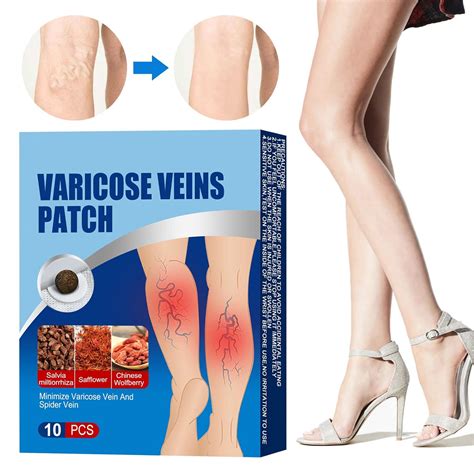 Herbal Patch for Varicose Veins Treatment, Improve Sri Lanka | Ubuy