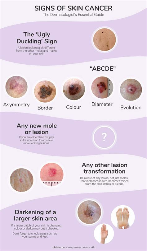 Skin Cancer Signs & Symptoms | The Dermatologist's Essential Guide