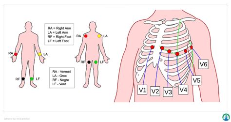 Best Way To Learn 12 Lead Ecg - Just For Guide