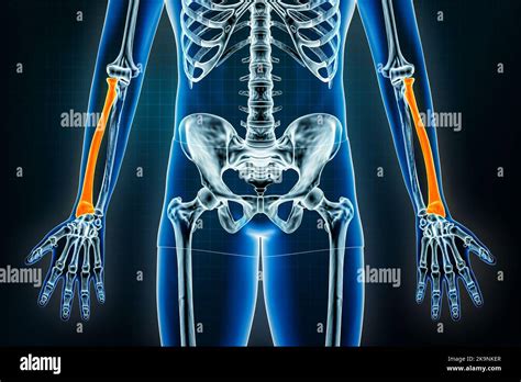 Radius or radial bone x-ray front or anterior view. Osteology of the ...