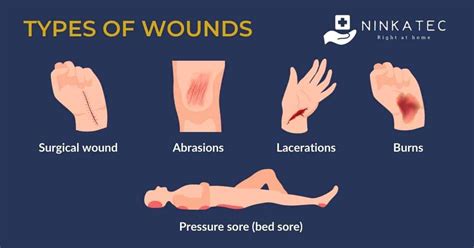 Caring For A Wound At Home: A Caregiver's Guide | Ninkatec