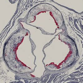 Aortic Valve Histology