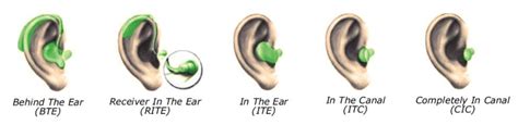 1: Different hearing aid types. | Download Scientific Diagram