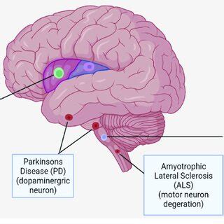 Neurodegenerative disease and the types of neurons affected. | Download ...