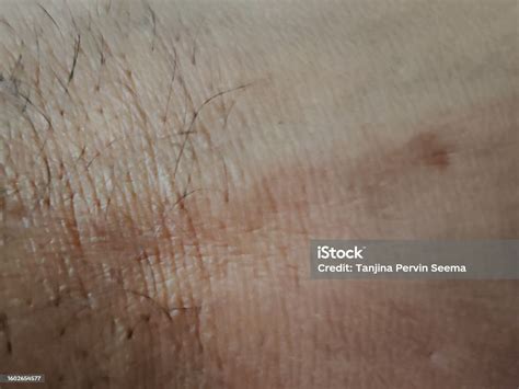 Human Body Skin Hand Skin Stock Photo - Download Image Now - Adult ...