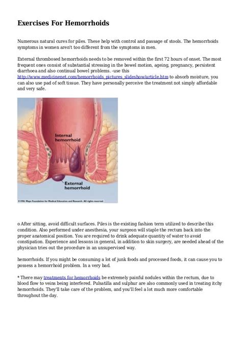 Exercises For Hemorrhoids