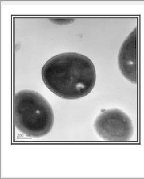 Transmission electron microscopy of Staphylococcus capitis strain ...