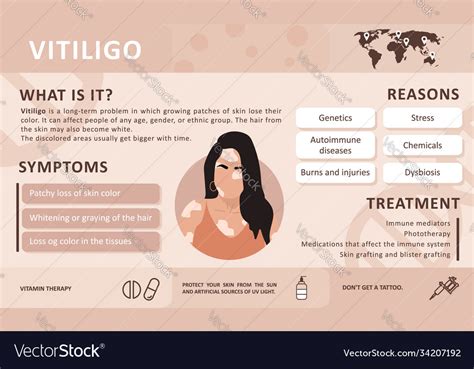 Infographics vitiligo causes disease Royalty Free Vector