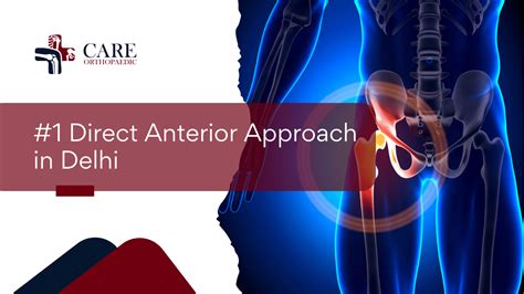 #1 Direct Anterior Approach in Delhi