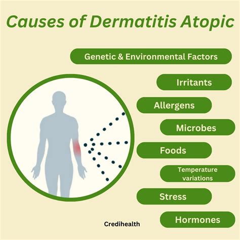 Dermatitis Atopic: What It is, Causes, Symptoms And Treatments ...