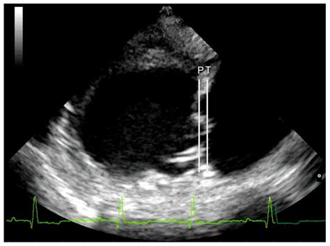 Myxomatous Mitral Valve Disease - Captions Beautiful