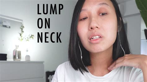 Lump On Neck Cancer Symptoms