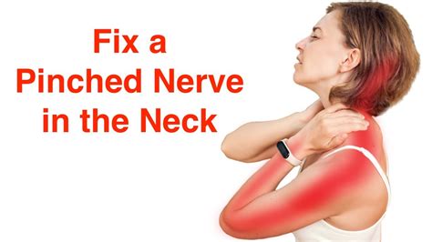 Home Treatment For Pinched Nerve In Neck And Shoulder - Bios Pics