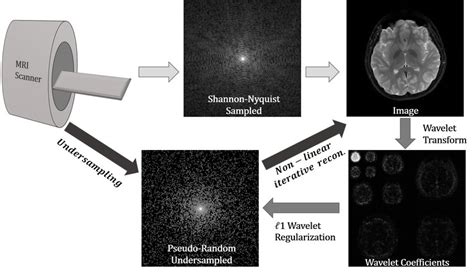 6 Compressed sensing MRI has three ingredients: 1) Incoherent ...