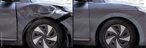 Photo Of Car Dent Repair Before Stock Photo | Adobe Stock