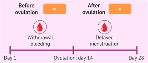 Morning-after pill: what are its effects and cost?