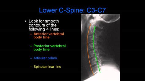 Cervical Spine Xray