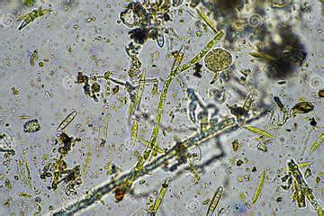 Fungal and Fungi Hyphae Under the Microscope in the Soil and Compost ...