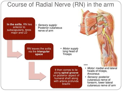 Radial nerve palsy