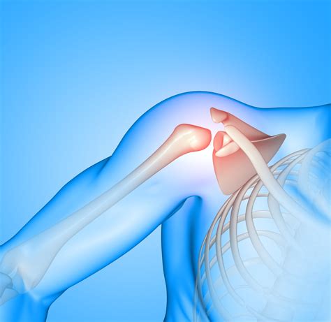 Shoulder Surgeries - Best Shoulder Pain Doctor In Aurangabad- Dr. PORE