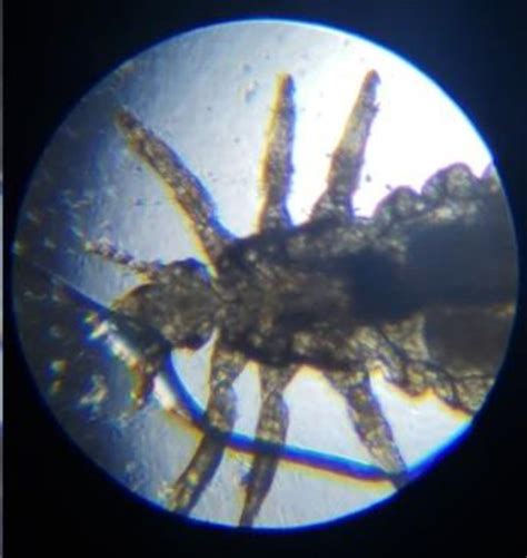 -Adult louse under microscope. Photo taken by author. | Download ...