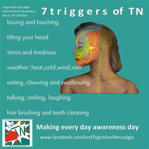 Pin by charlene ranger on ailments. | Trigeminal neuralgia, Neuralgia ...