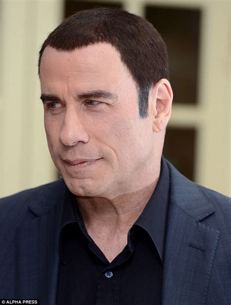 John Travolta hair transplant after going bald?