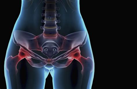 How Rheumatoid Arthritis Affects Each Part of the Body