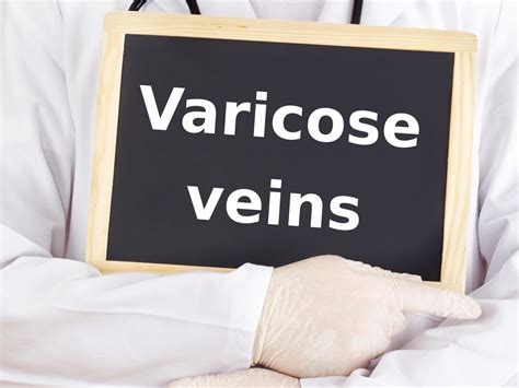 View Common Causes and Treatment Options for Varicose Veins