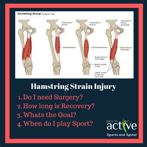 Hamstring Strain Injuries - Back to Active Sports and Spinal ...